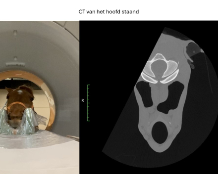 CT of the head standing