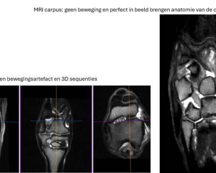 MRI of tarsus and carpus